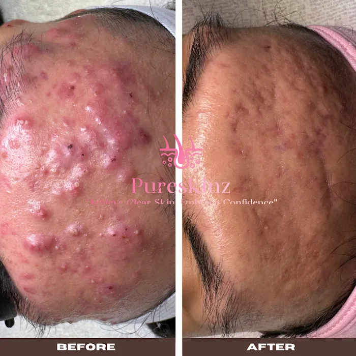 Sacramento Skin Clinic Pureskinz Picture 3