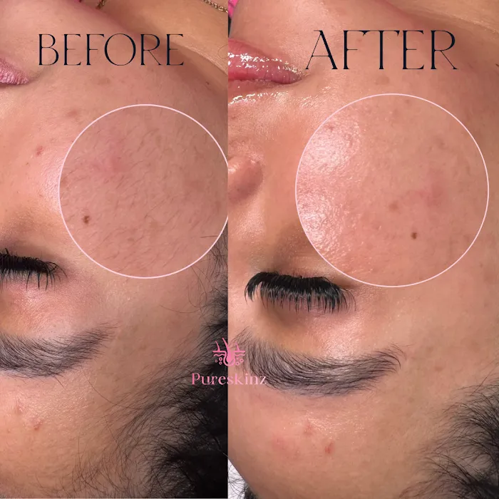 Sacramento Skin Clinic Pureskinz Picture 4