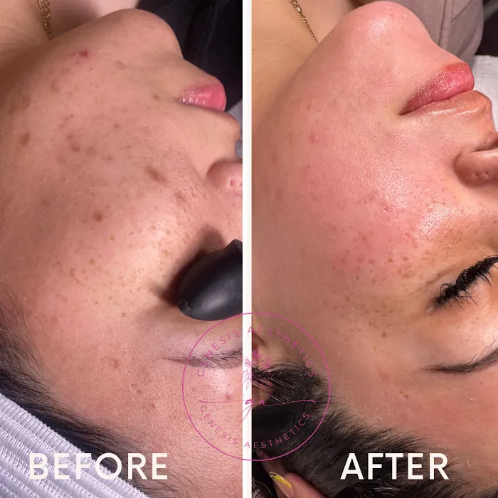 Sacramento Skin Clinic Pureskinz Picture 6