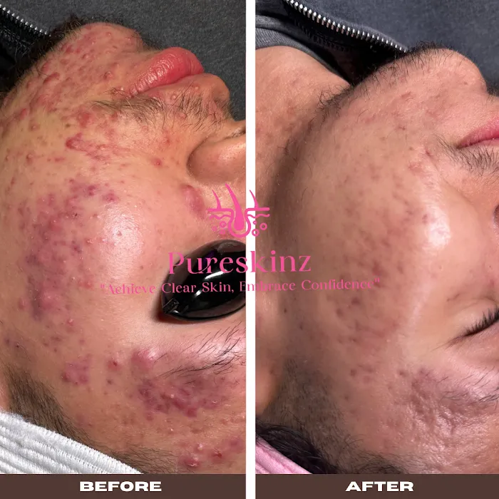 Sacramento Skin Clinic Pureskinz Picture 7