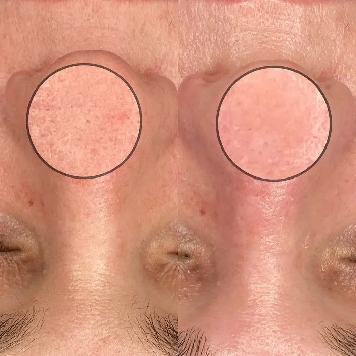 Butterscotch and Beauty Picture 4