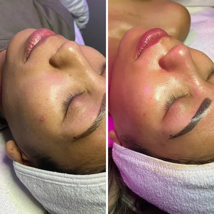 Sweet Medusa Beauty Picture 4