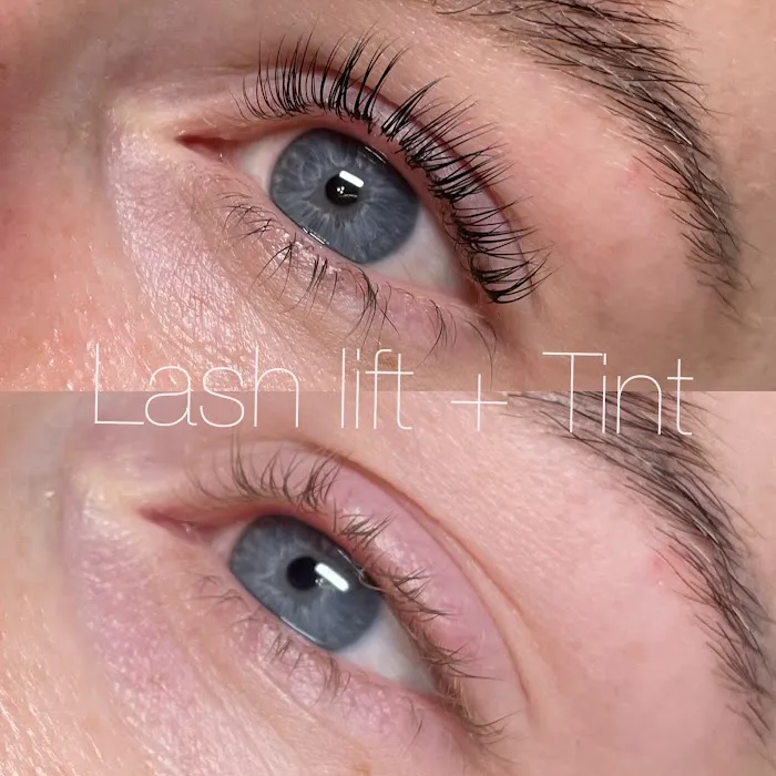 Ludo Acne & Aesthetics Picture 2