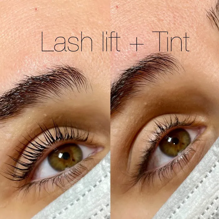 Ludo Acne & Aesthetics Picture 5