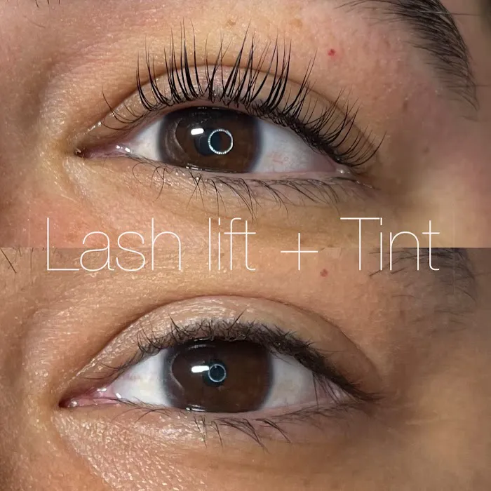 Ludo Acne & Aesthetics Picture 4