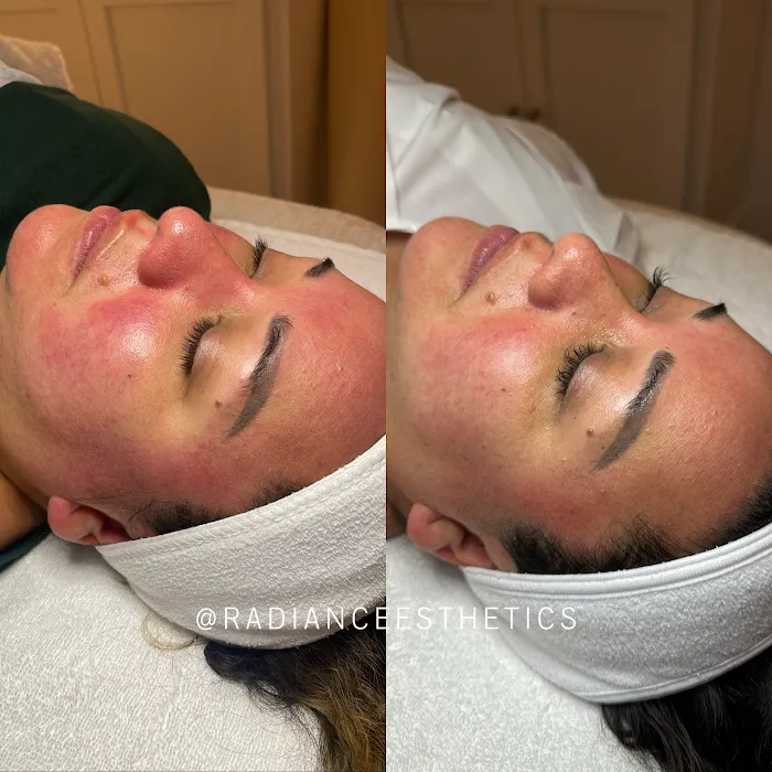 Radiance Esthetics Picture 3