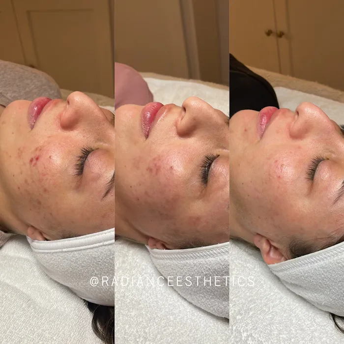 Radiance Esthetics Picture 4