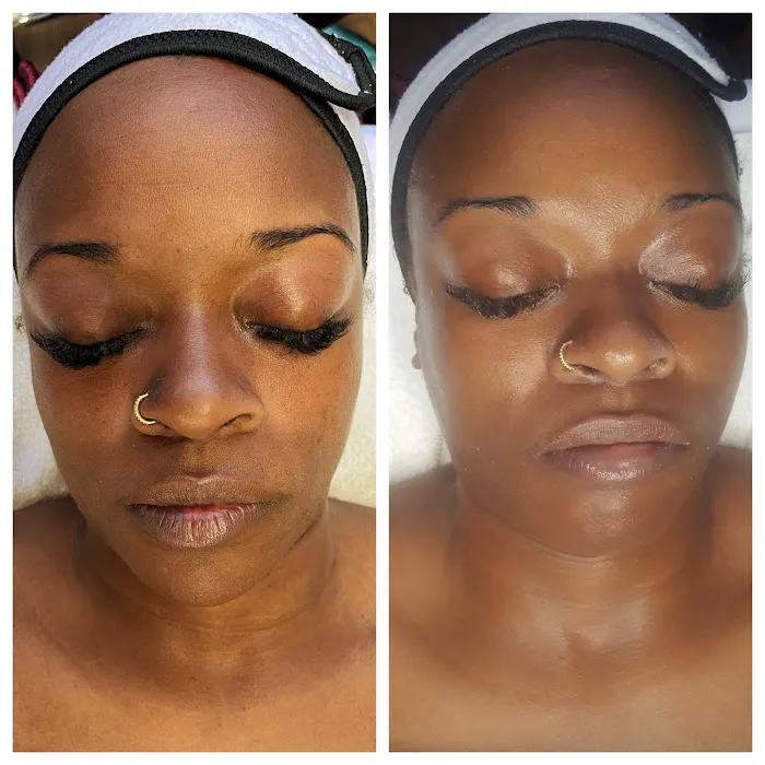 Pure Touch Esthetics Picture 1