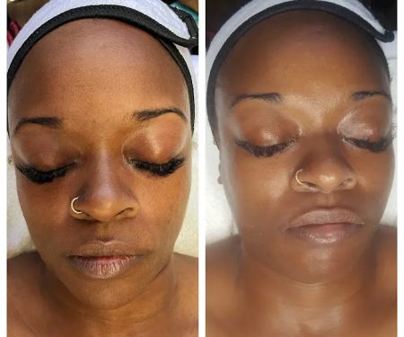 Pure Touch Esthetics