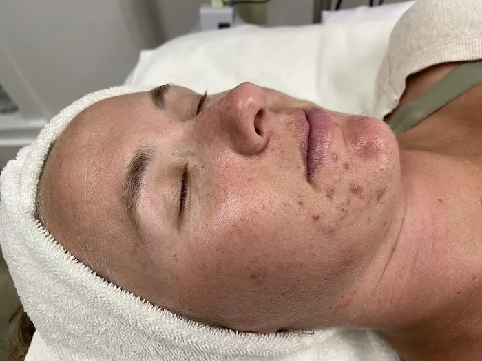 SereniSkin Picture 1