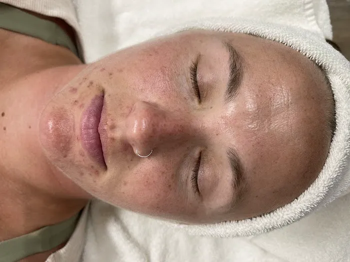 SereniSkin Picture 5