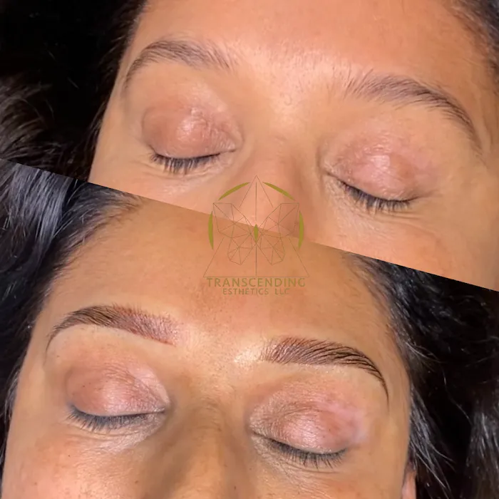 Transcending Esthetics Picture 3