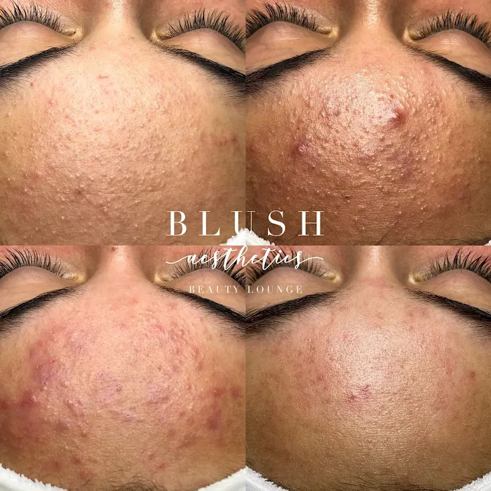 Blush Aesthetics Beauty Lounge Picture 4