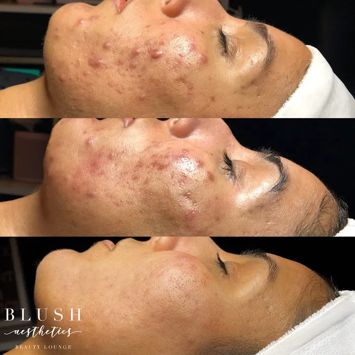 Blush Aesthetics Beauty Lounge Picture 3