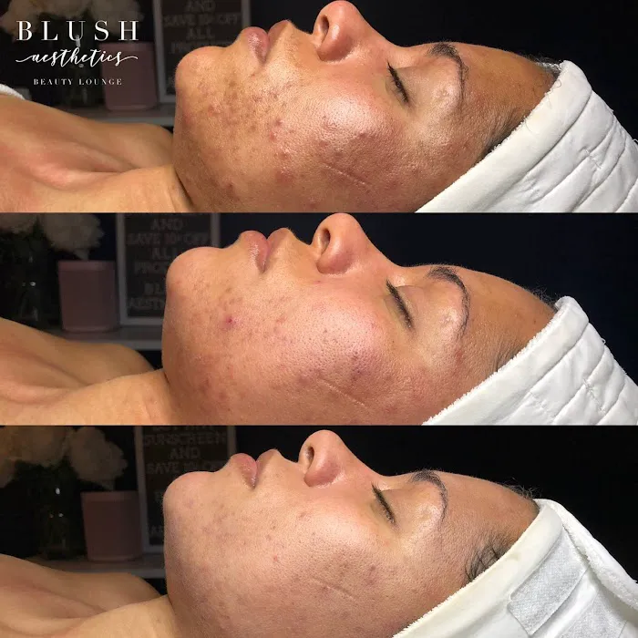 Blush Aesthetics Beauty Lounge Picture 5