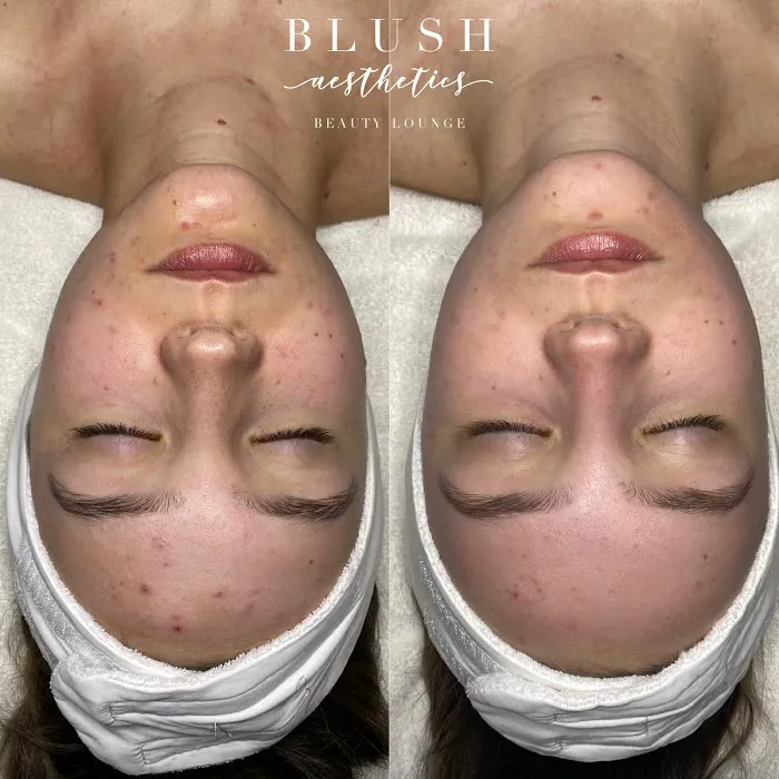 Blush Aesthetics Beauty Lounge Picture 7