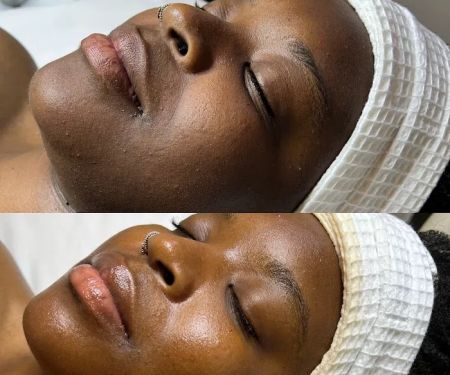 Skin Therapy Inc.