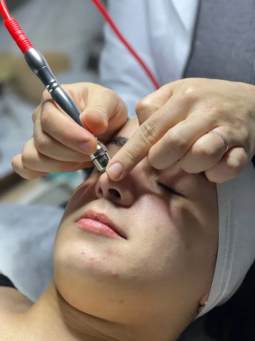 Skin house Picture 9