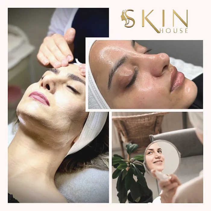 Skin house Picture 7