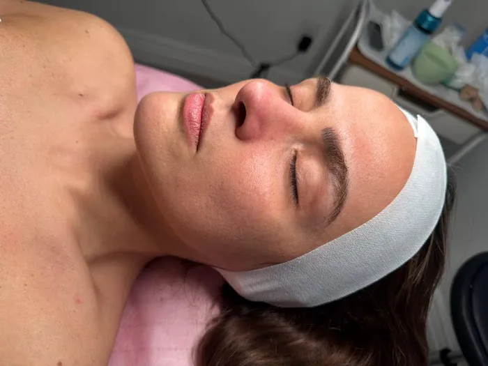 Skin house Picture 10