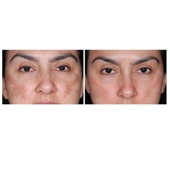 Vskincareline Picture 7