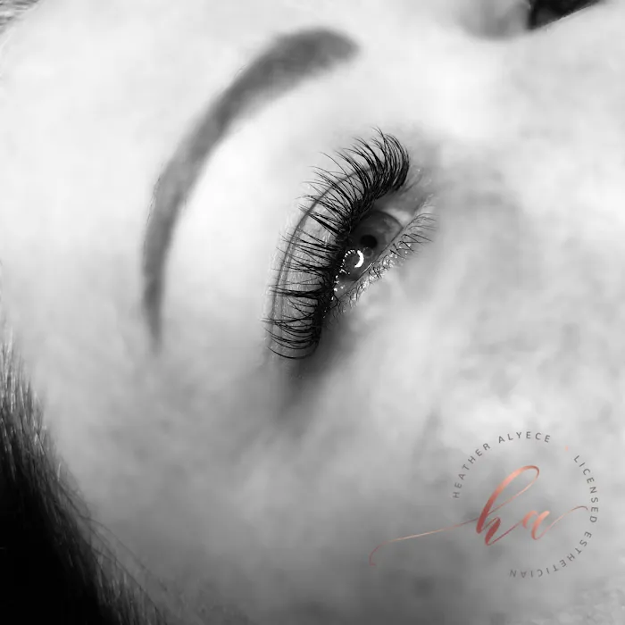 heather alyece esthetics Picture 4