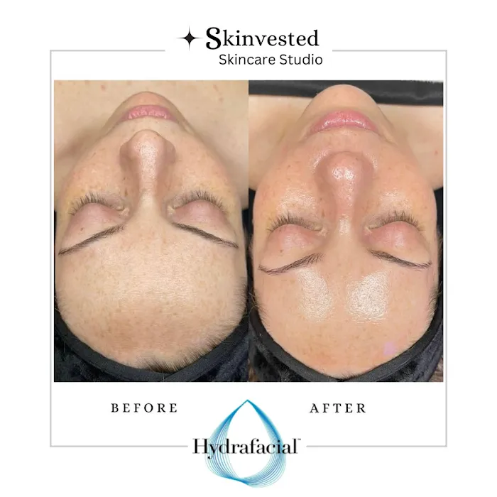 Skinvested Skincare Studio Picture 3