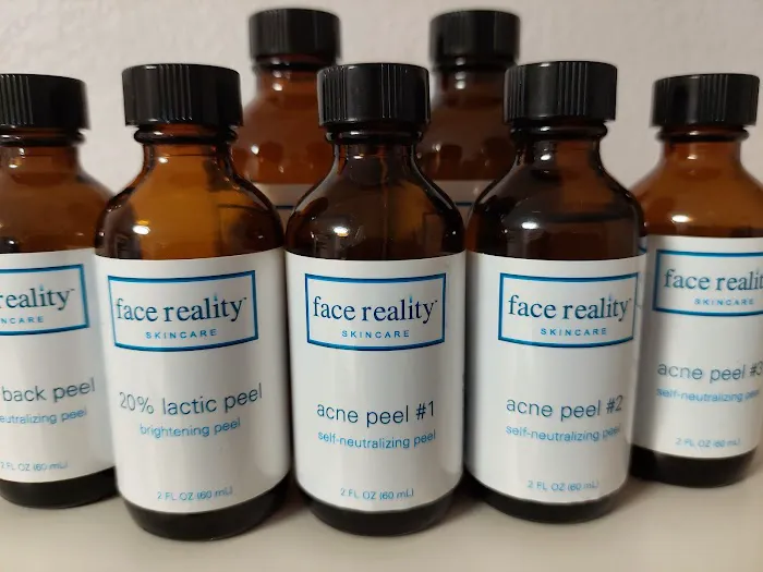 Fair Oaks Acne Care | Eva Cain Esthetics Picture 4