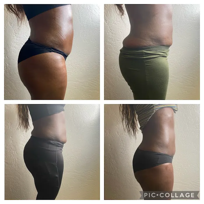 Levels To Skin Picture 4