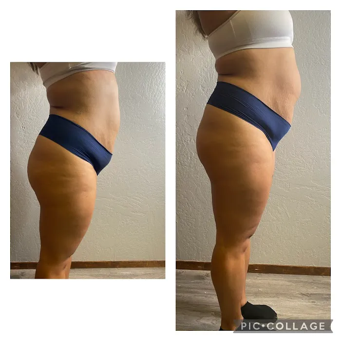 Levels To Skin Picture 3