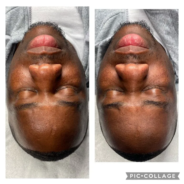 Levels To Skin Picture 1