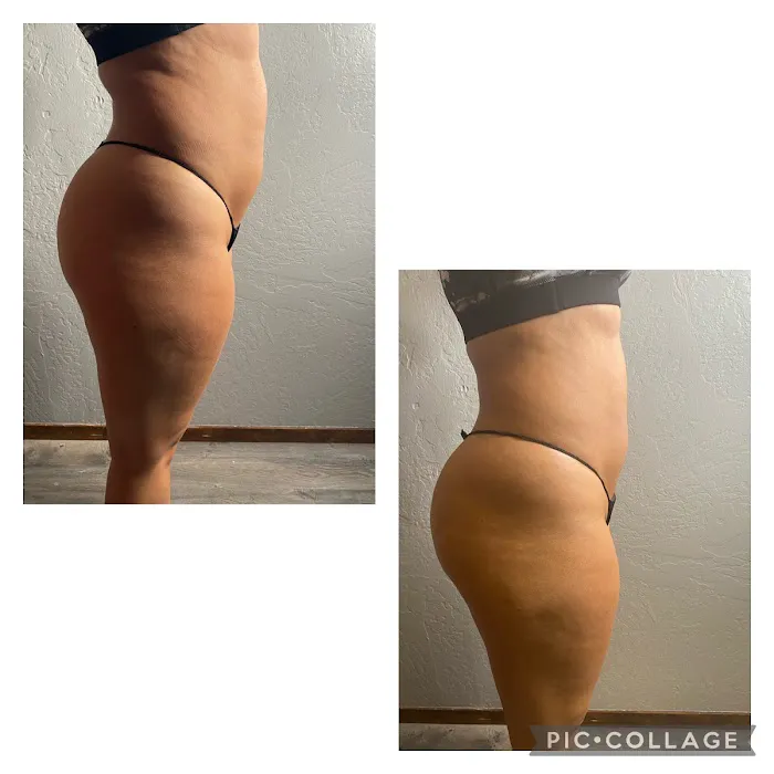 Levels To Skin Picture 6