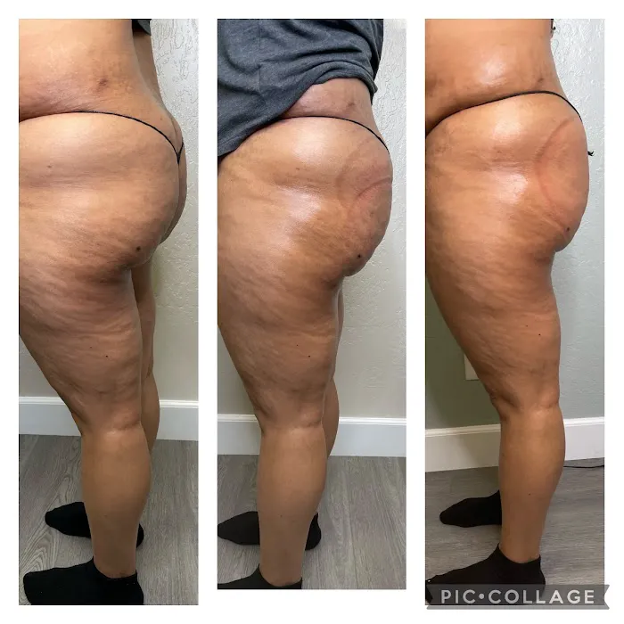 Levels To Skin Picture 9