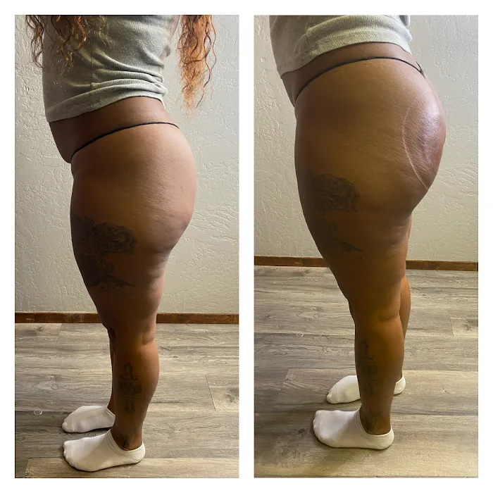 Levels To Skin Picture 10