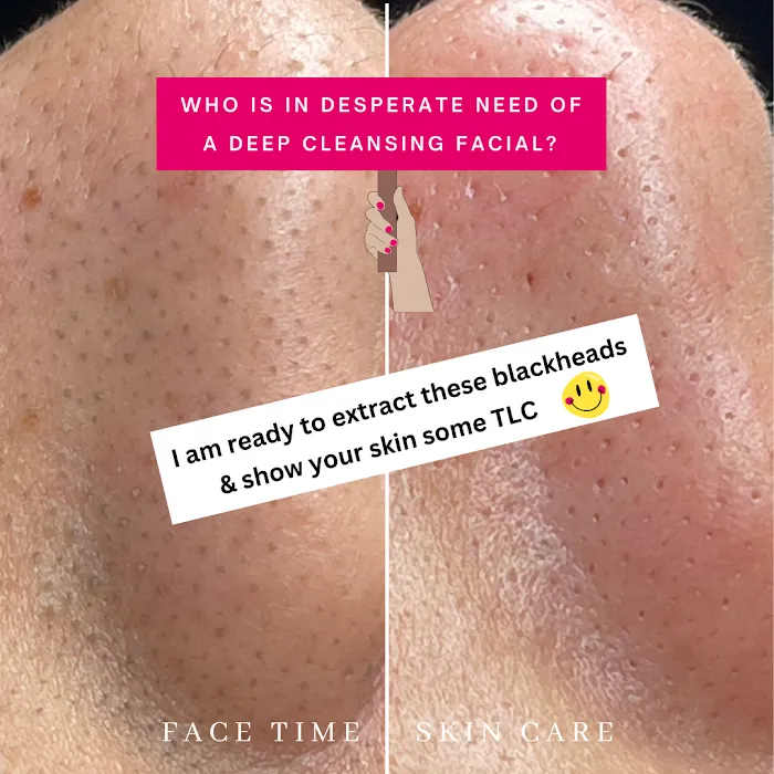 Face Time Skin Care Picture 2