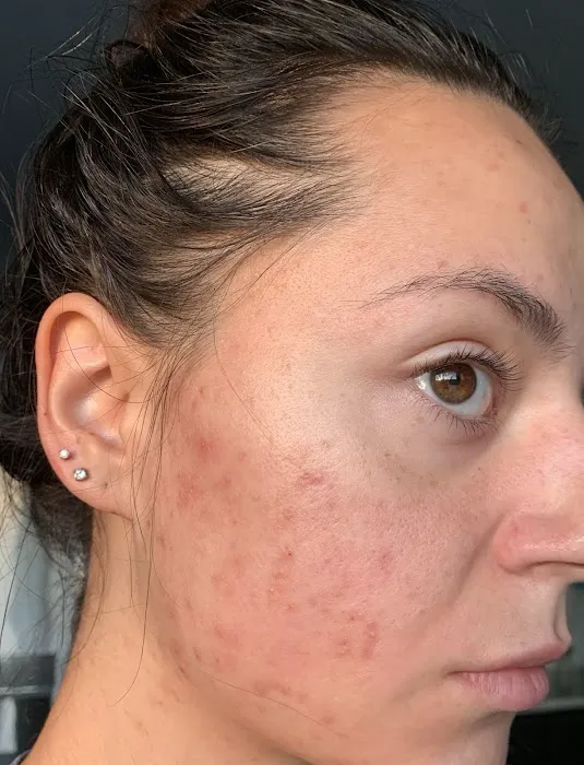 Face Time Skin Care Picture 1