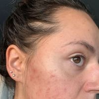 Face Time Skin Care ico