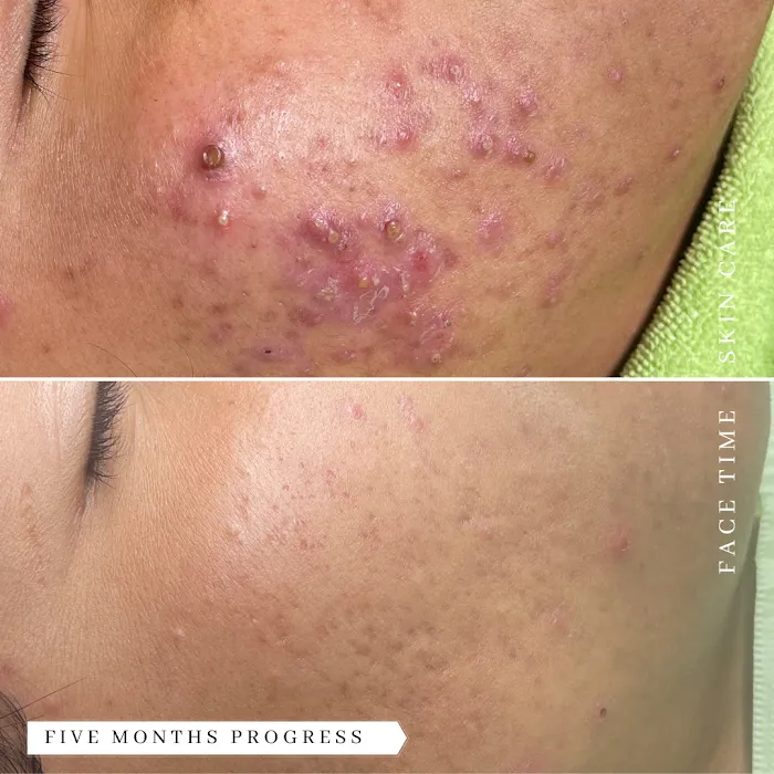 Face Time Skin Care Picture 4