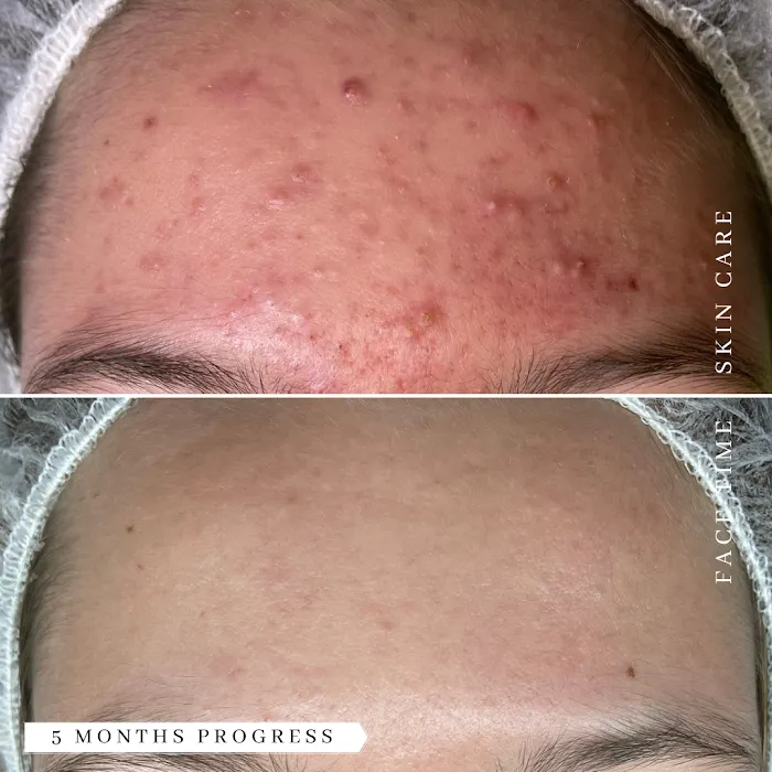 Face Time Skin Care Picture 5