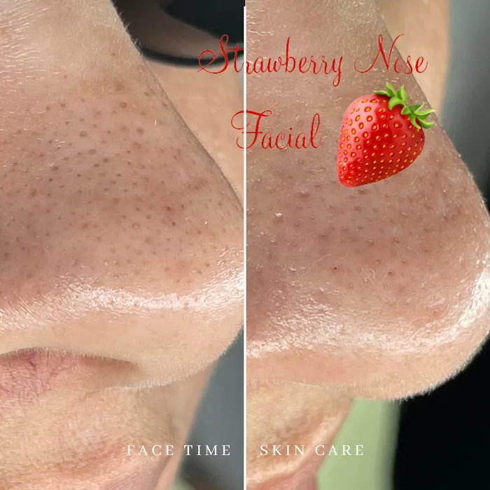 Face Time Skin Care Picture 7