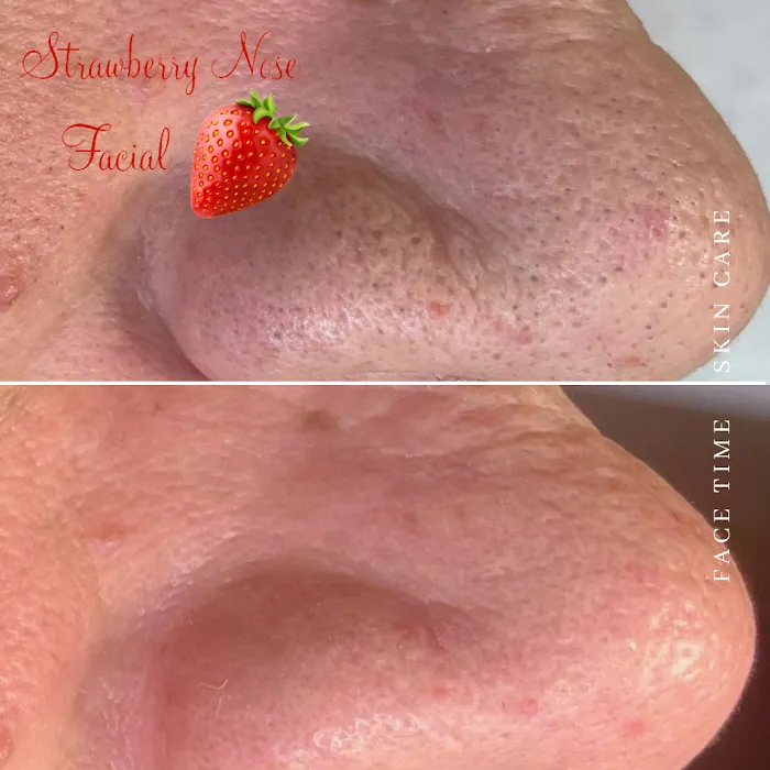 Face Time Skin Care Picture 6