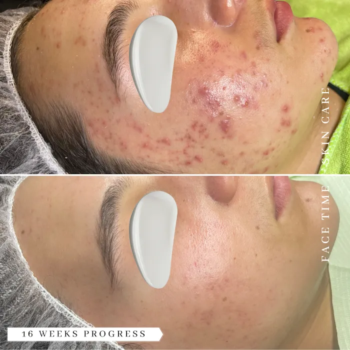 Face Time Skin Care Picture 8