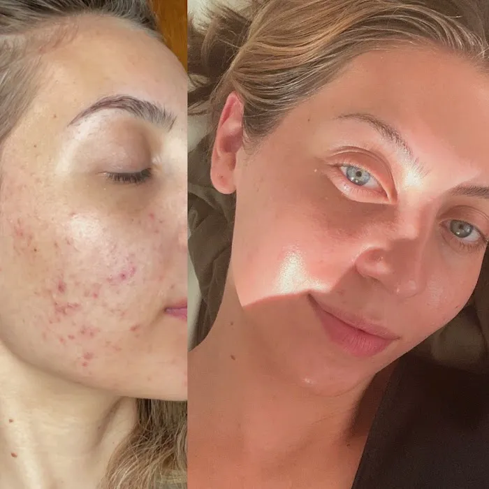 New Light Esthetics Picture 3