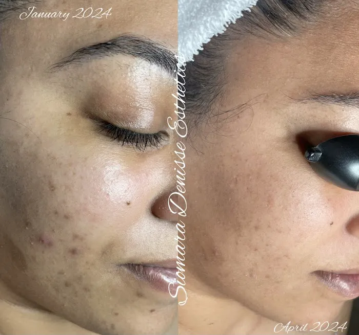 Siomara Denisse Esthetics Picture 1