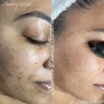 Siomara Denisse Esthetics