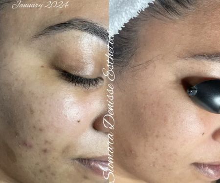 Siomara Denisse Esthetics