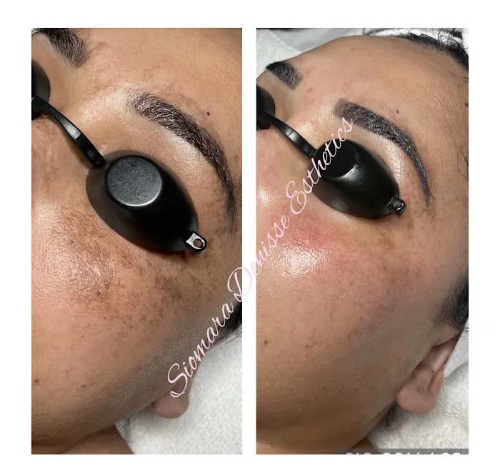 Siomara Denisse Esthetics Picture 9