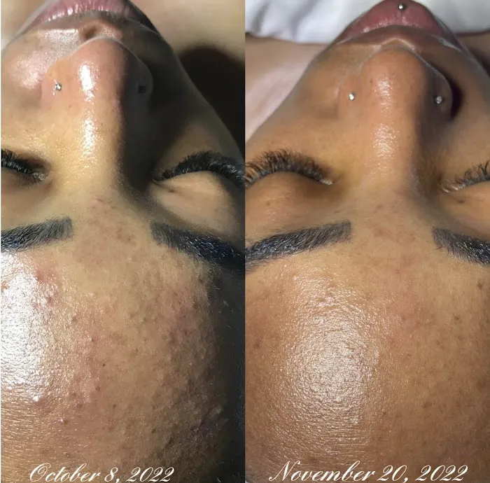 Siomara Denisse Esthetics Picture 3