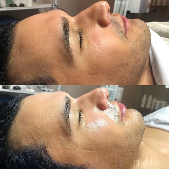 Skin Klarity Picture 4