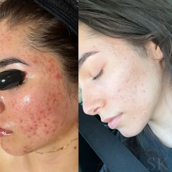 Skin Klarity Picture 7